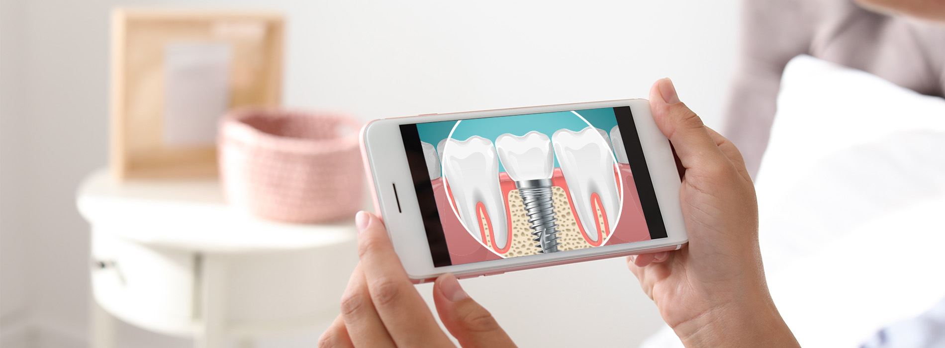 A person holding a smartphone displaying an image of teeth, with their hands visible in the foreground.