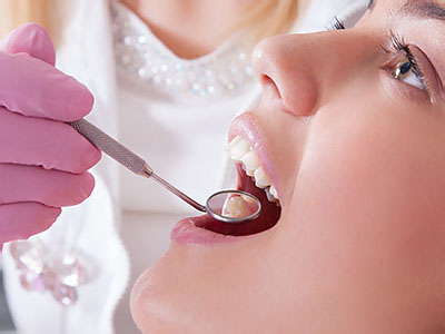 The image shows a dental professional performing oral care on a patient, with the patient s mouth open and the dental professional using a tool to clean or examine teeth.